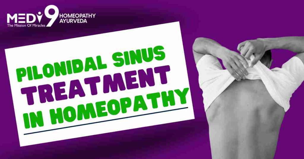 pilonidal sinus treatment in homeopathy