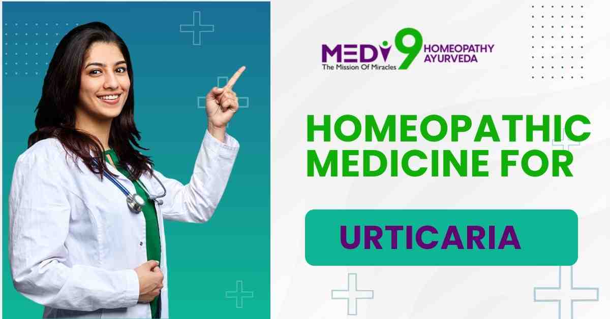 homeopathic medicine for urticaria