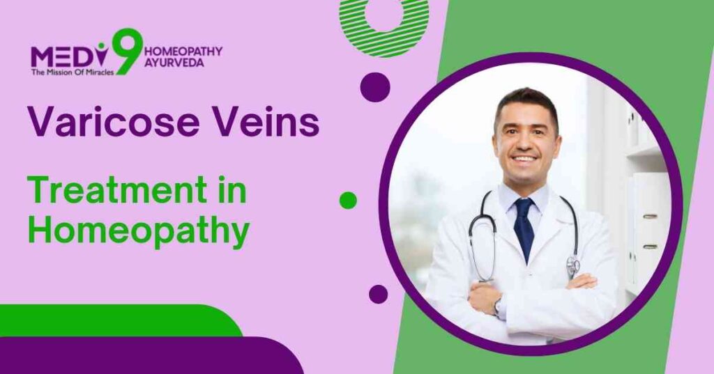 varicose veins treatment in homeopathy