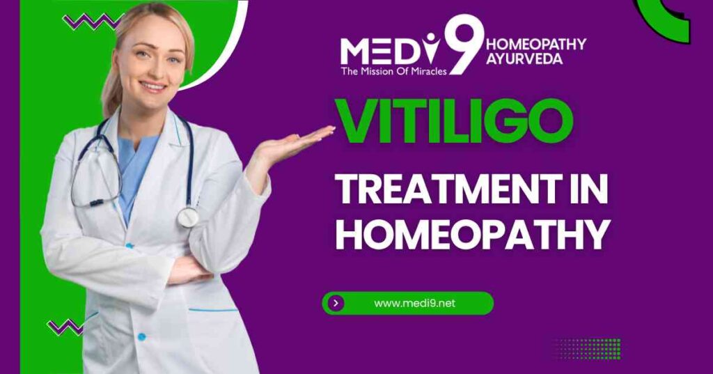 vitiligo treatment in homeopathy